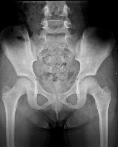 아주 좋은 품질의 많은 xray 이미지