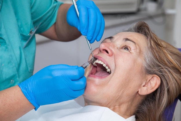 Foto donne mature nel trattamento della gengivite dal dentista