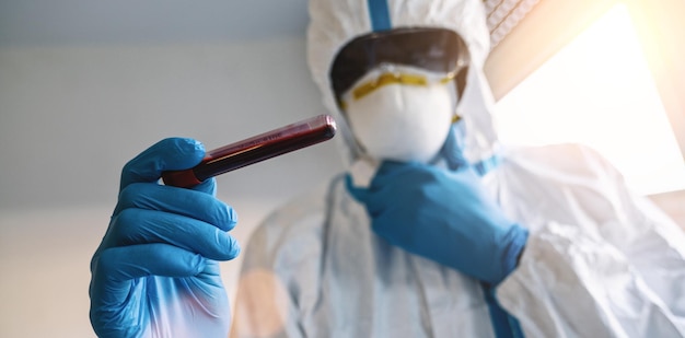 Medic in protective clothing with blood sample for Covid19 test for antibodies in the laboratory