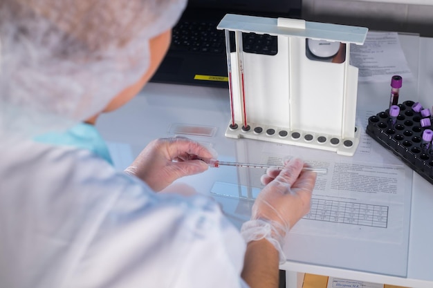 Medical clinic nurse at her workplace filling up the pipette with blood