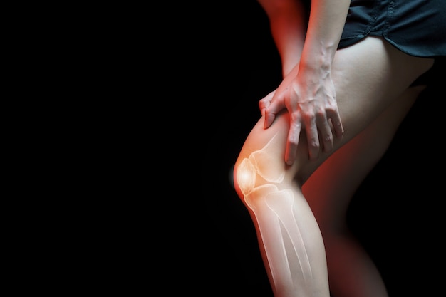 Medical concept, Woman suffering  with knee painful - skeleton x-ray,