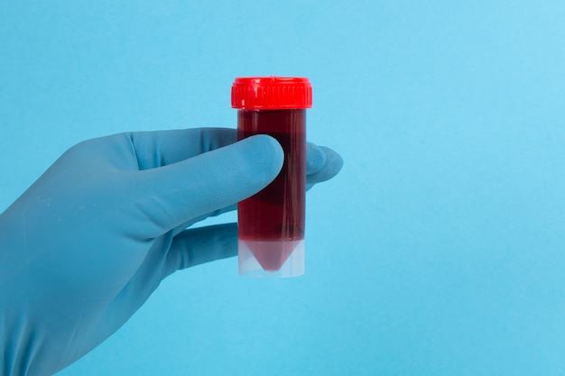 Medical container with blood tests in hand on a blue background. Virus and coronavirus concept