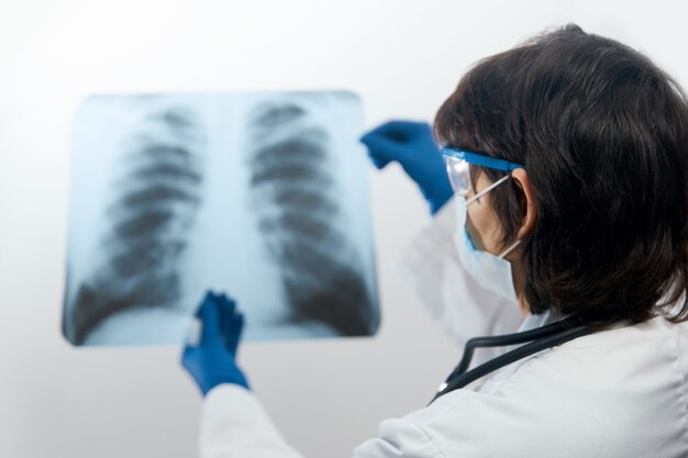Medico che esamina l'immagine a raggi x dei polmoni per la polmonite virale di un paziente con coronavirus