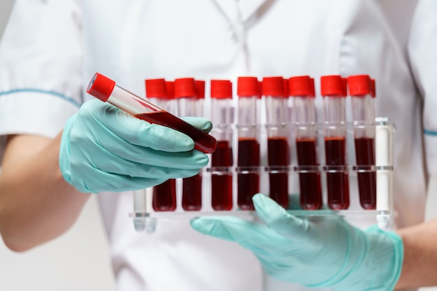 Medical doctor nurse woman wearing protective mask and gloves - holding rack with virus blood tests