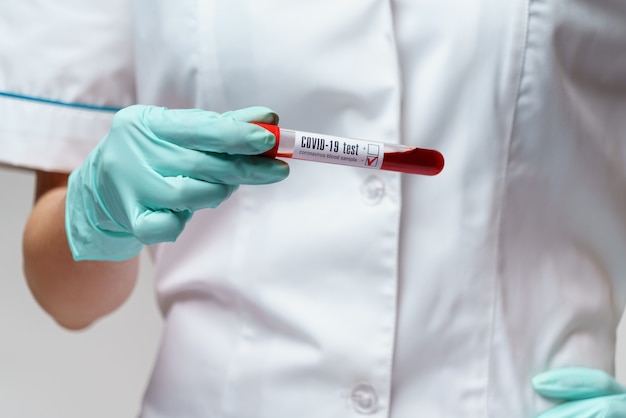 Photo medical doctor nurse woman wearing protective mask and gloves - holding virus blood test