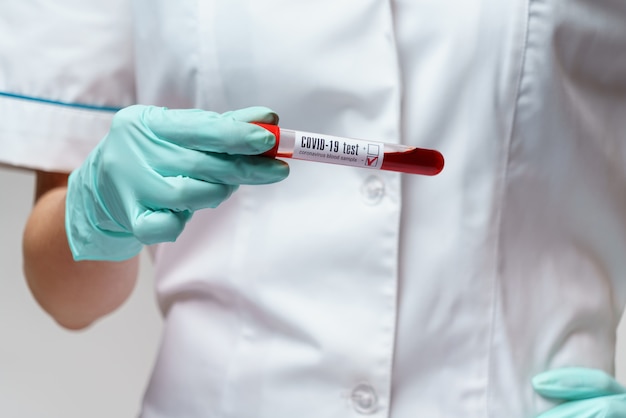 Medical doctor nurse woman wearing protective mask and gloves - holding virus blood test