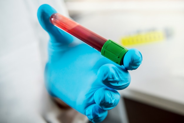 Medical equipment. Blood test. Tubes and containers. Background.