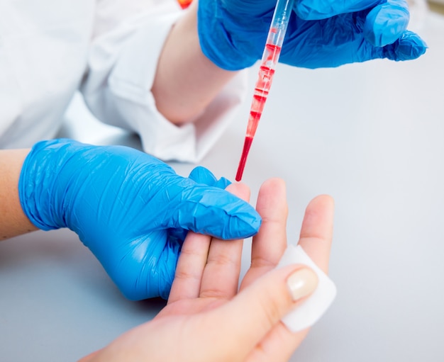 Medical equipment. Blood test. Tubes and containers.