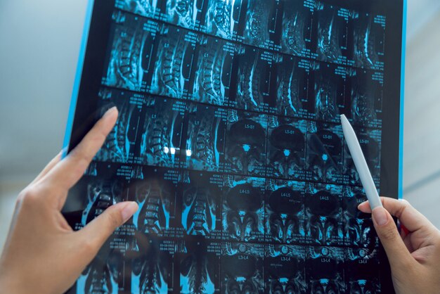 의료 장비. 의사 찾고 MRI 사진입니다.