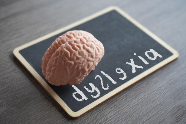 Medical and healthcare concept Closeup image of human brain model and chalkboard with text DYSLEXIA