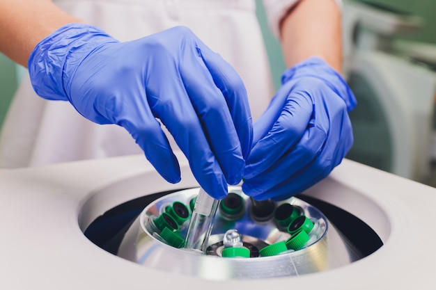 Medical laboratory centrifuge with test tubes with blood.