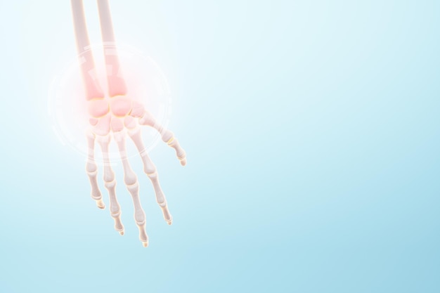 Medical poster image of the bones of the hand, arm bones.\
arthritis, inflammation, fracture, cartilage,. copy space, 3d\
illustration, 3d render.