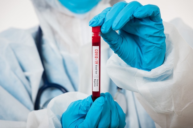 Medical scientist in PPE uniform wear a mask holding test tube Coronavirus test blood sample