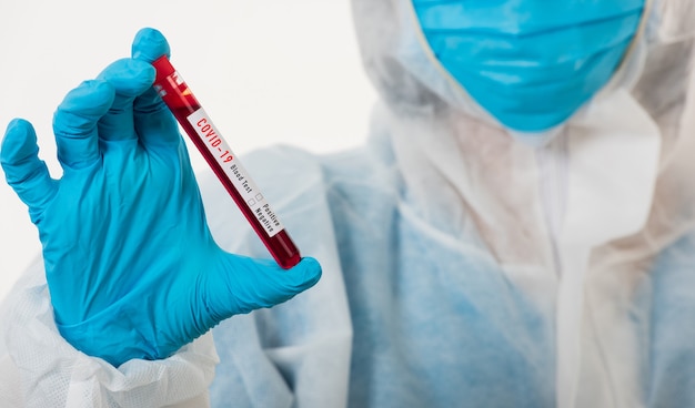 Medical scientist in PPE uniform wear a mask holding test tube Coronavirus test blood sample