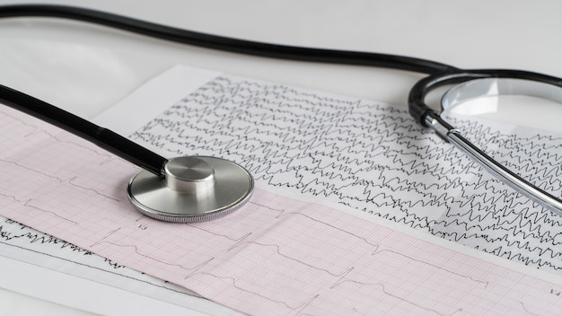 Medical stethoscope and cardiogram on light background