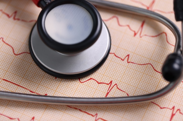 Photo medical stethoscope and printed cardiogram on table. cardiologist services concept