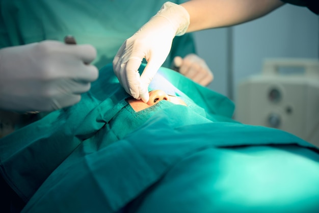 Medical team doctor Working in the operating room Doing nose surgery on a female patients