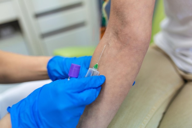 Medical technologist doing a blood draw services for patient lab assistant with sterile rubber gloves taking blood sample from patient