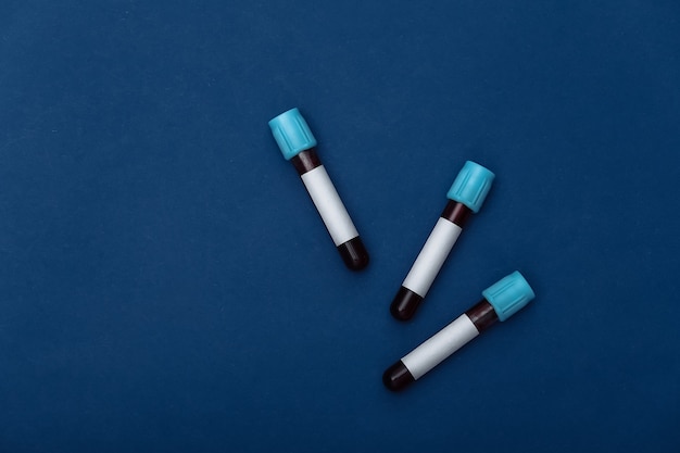 Medical test tubes with blood on a classic blue background. Top view