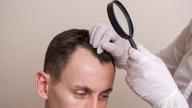 Medical worker in gloves and with a magnifying glass examines the head of a balding man close-up