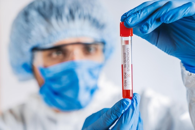 Medical worker or scientific holding corona virus blood test tube from patient