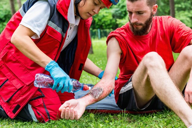 Medical worker treating burns on male039s hand