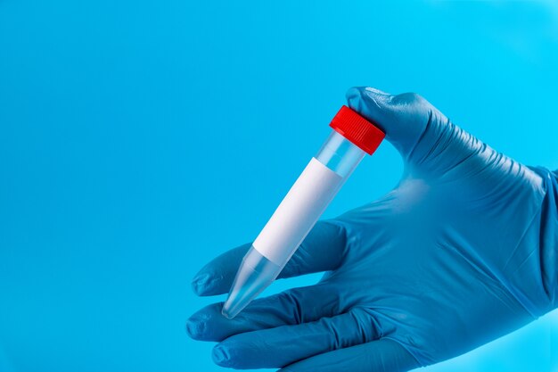 medical workers hand in a sterile glove holds a clean blood test tube.