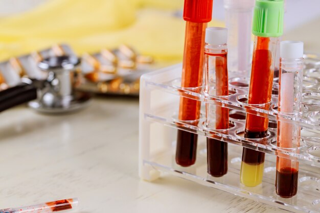 Medical working with blood sample in laboratory