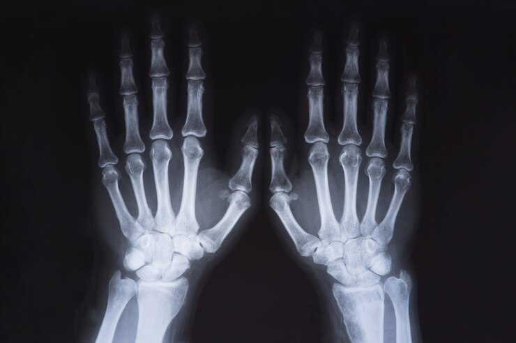 Medical x ray hands image 