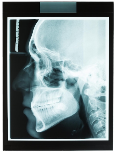 Foto radiografia medica sul tavolo