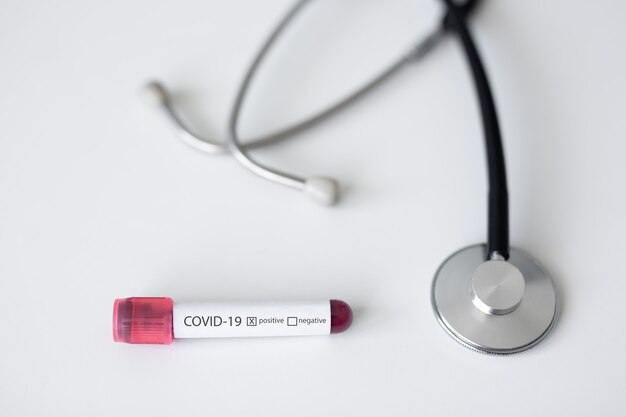 Medicine, health care and pandemic concept - stethoscope and coronavirus covid-19 positive blood test over white background