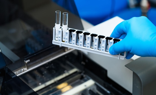 Medicine modern researchment of biological sample. Laboratory analyzing test tubes.