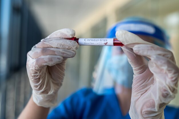 Medisch werker die een reageerbuis met bloedmonster vasthoudt om een nieuw virus Coronavirus covid 19 in onderzoekslaboratorium te detecteren