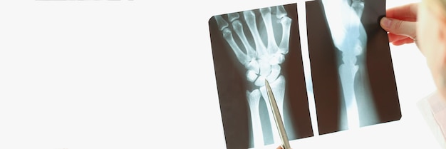 Medisch werker onderzoekt het resultaat van de röntgenfoto van de patiënt op licht
