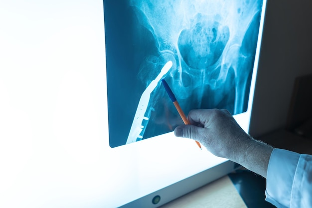 Medische hulpverleners in het ziekenhuis onderzoeken röntgenafdrukken