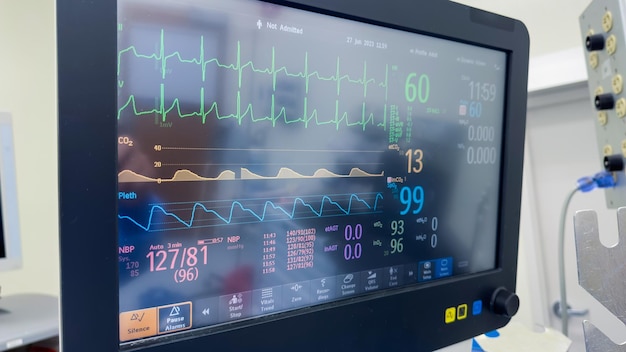 Foto medische monitor voor vitale functies die kritieke gezondheidsstatistieken bloeddrukpulstemperatuur weergeeft