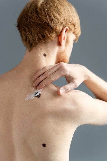 Photo medium shot man applying cream on mole