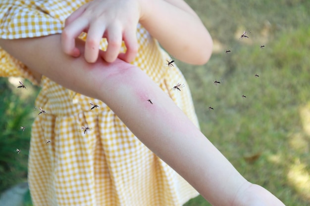 Meisje heeft allergie voor huiduitslag en jeuk op haar arm door muggenbeet