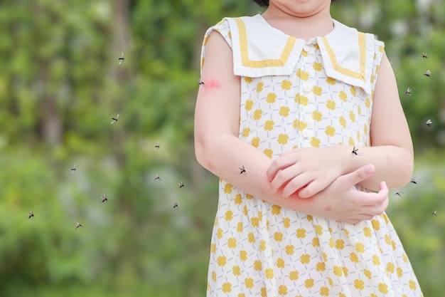 Meisje heeft huiduitslag, allergie, jeuk en krabben op haar arm met muggenbeet