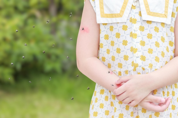 Meisje heeft huiduitslag, allergie, jeuk en krabben op haar arm met muggenbeet