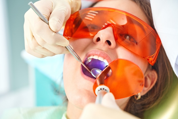 Meisjeskind bij de arts. Tandarts plaatst een vulling op een tand met tandheelkundige polymerisatielamp in de mondholte. over kliniekachtergrond