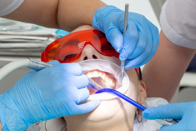 Meisjespatiënt bij de receptie bij de tandarts. behandeling van carieuze tand. het meisje ligt met open mond op de tandartsstoel. Een tandarts en zijn assistent behandelen een tand
