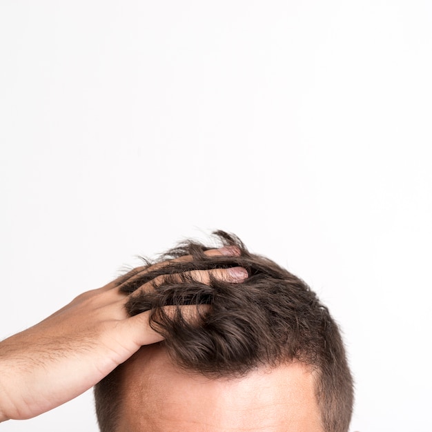 Foto mens die het probleem hebben dat van de haardaling zich tegen witte achtergrond bevindt