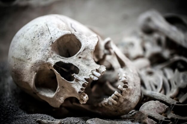 Menselijke Dood Skelet Botten en Schedel Foto