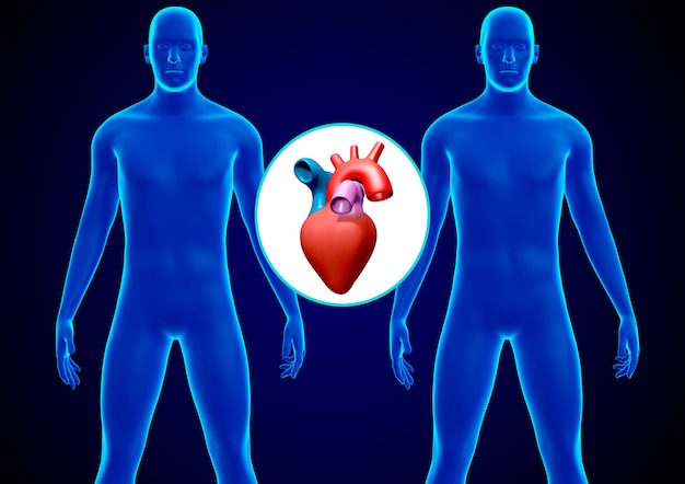 Menselijke harttransplantatie. vervanging van een ziek hart door een gezond donorhart. 3D-rendering