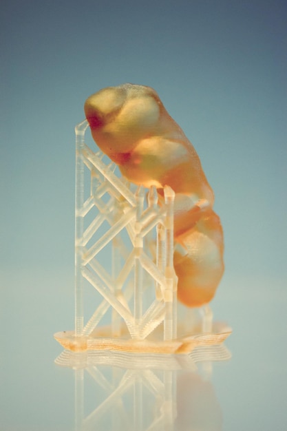 Menselijke kaak gedrukt op 3D-printer van fotopolymeer