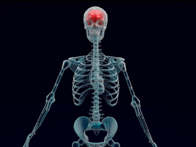 Menselijke rode hersenen X-ray op zwarte achtergrond