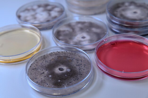 사진 제약 생물 과학 연구를 위한 페트리 접시에서 미생물학적 배양 코로나19