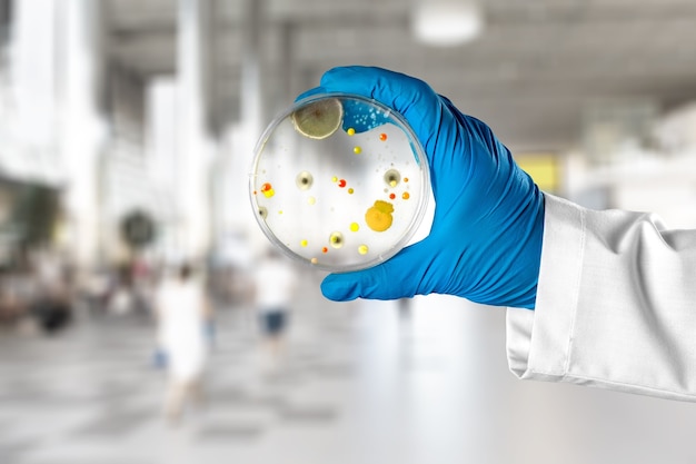 Microbiologie laboratoriumtest in wetenschapper hand op achtergrond