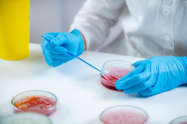 Microbiology laboratory work hands of a microbiologist working in a biomedical research laboratory using a disposable inoculation rod to inoculate blood agar in a petri dish
